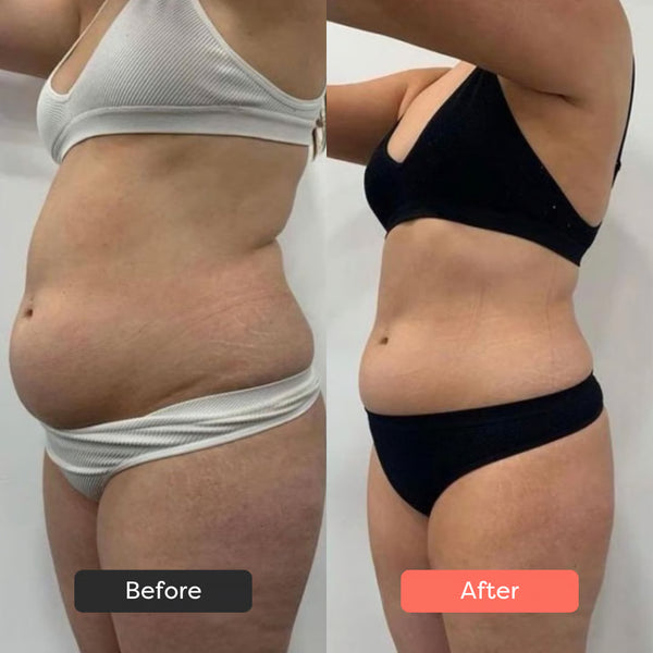 My skin looks fresher & stretch marks are lighter