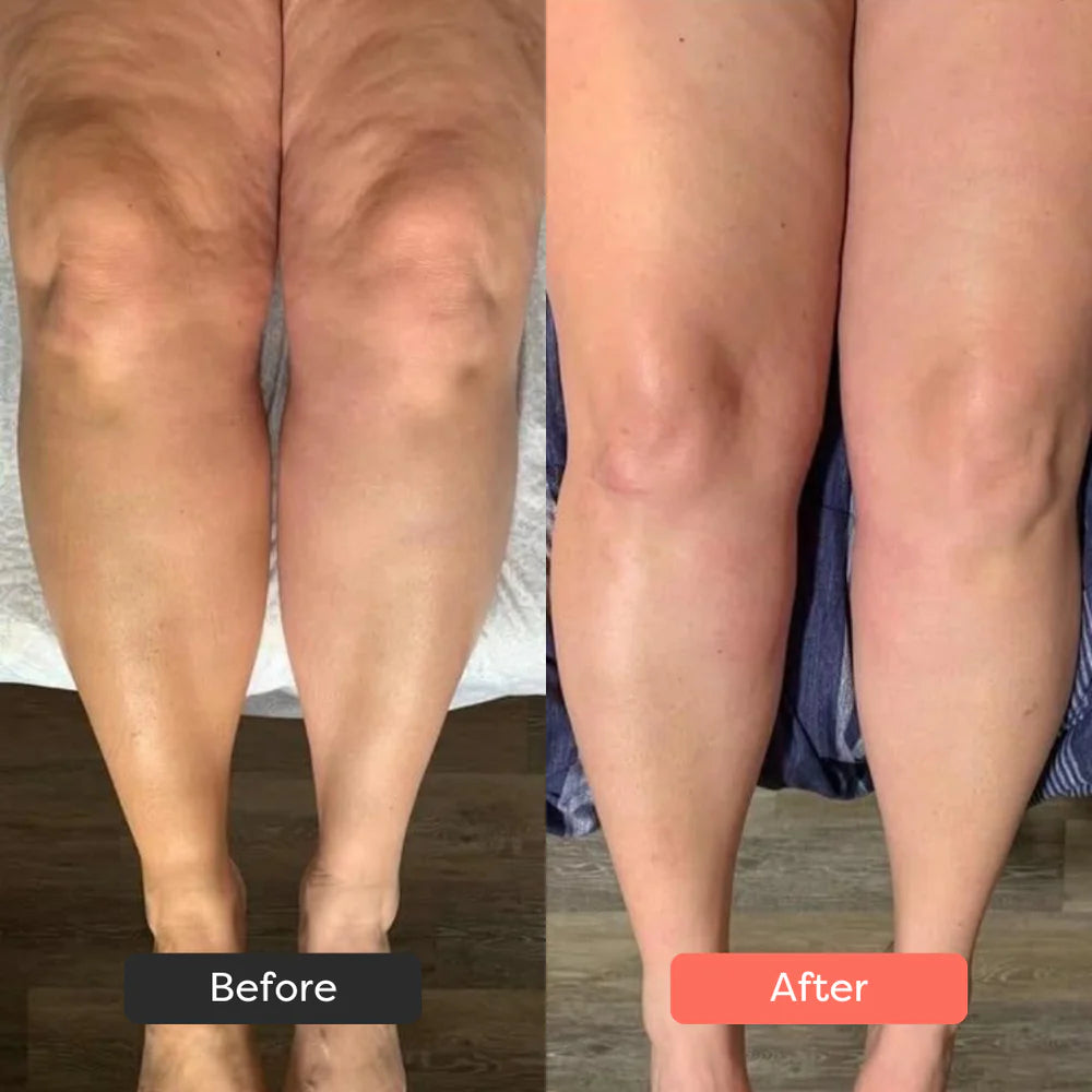 SaviaParis Body Sculpting Device