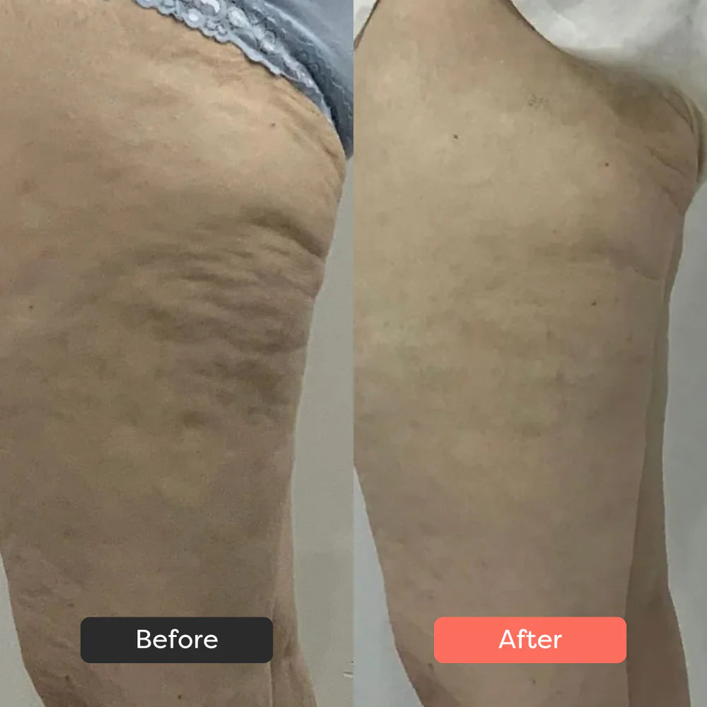 SaviaParis Body Sculpting Device