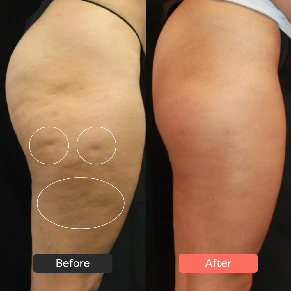 SaviaParis Body Sculpting Device