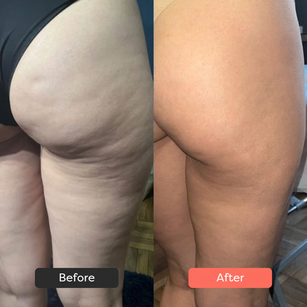 After just three weeks, my thighs became smoother!